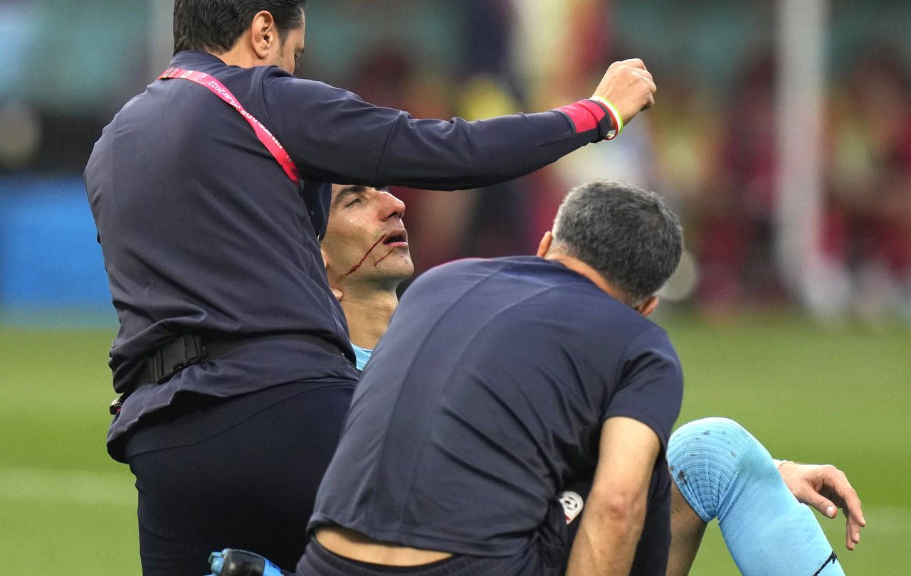 Iran's goalkeeper Alireza Beiranvand is attended by team support staff after he was injured during ...
